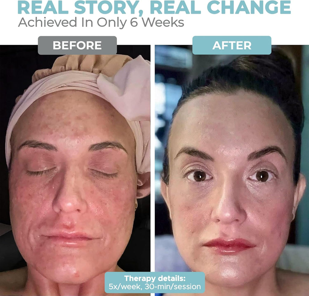 Revolutionary LED Light Therapy Face & Neck Mask - 7 Color Anti-Aging Treatment for Youthful Skin
